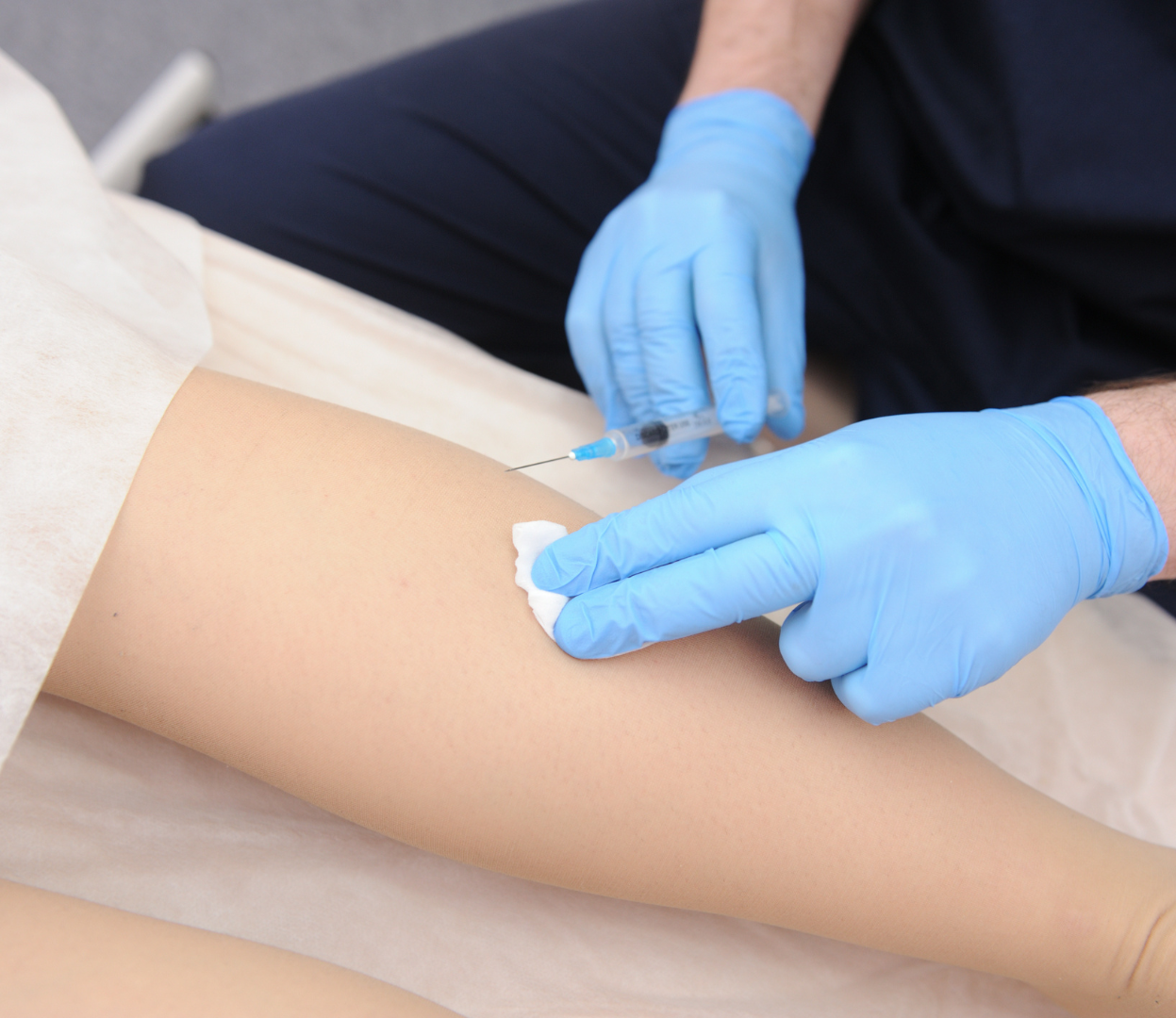 Sclerotherapy